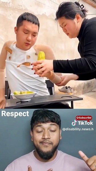 Inspirational Amputee Boy Movie: Disabled Armless Man Overcomes Challenges