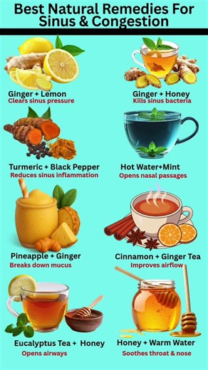 Best Natural Remedies for Sinus & Congestion 🤧 | Clear Your Nose Naturally