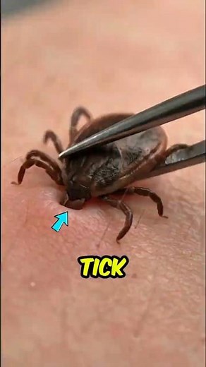 If You Ever Wondered Why Pulling a Tick Fast Can Make It Worse 😳