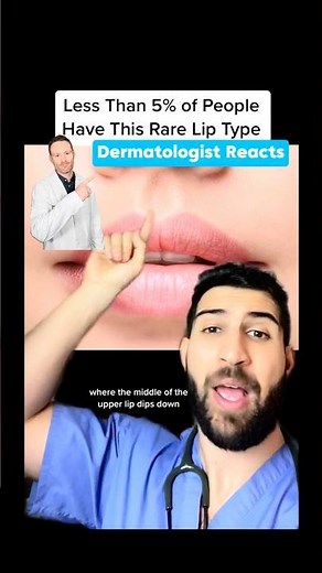 💋 Cupid’s Bow Lips: Rarest or Not? 🤔