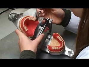 Opstelling tanden - Tandtechnieken & Dentaaltechnieken en suprastructuren - Vesaliusinstituut