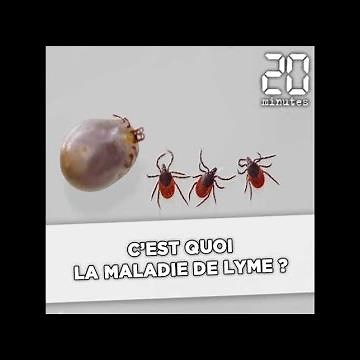 C'est quoi la maladie de Lyme ?