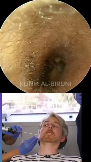 All of that found in the ear 🥹😩