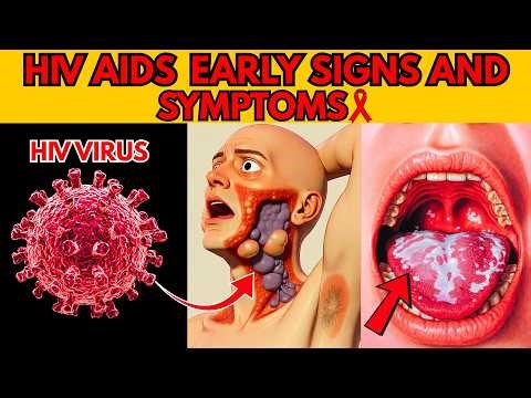 Identify HIV AIDS Early Signs and Symptoms | Signs Of HIV Positive | HIV AIDS Symptoms