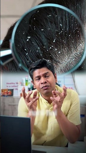 Scalp Psoriasis ko Dandruff Mat Samjho! | Symptoms, Causes & Treatment | Dr. Rohit Goel