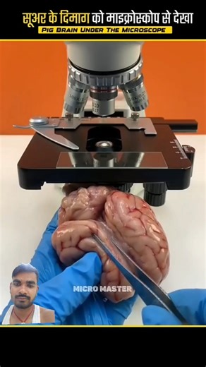 Pig 🐖 brain 🧠 under the microscope 🔬 |fact mine| ##shorts #ytshorts #trending #viralvideo #foryou