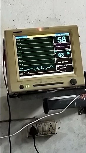 Live Patient Death In Hospital Check Patient moniter