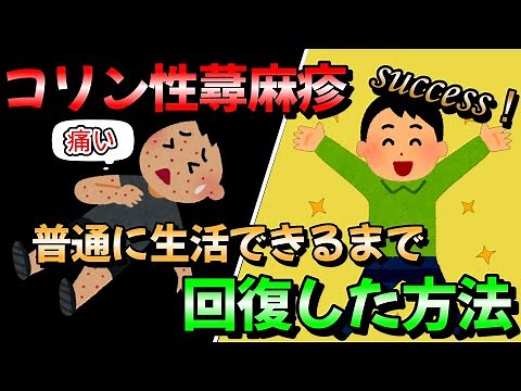 【コリン性蕁麻疹】普通に生活できるまで回復した方法［特発的後天性全身性無汗症,治し方,汗アレルギー,入院］