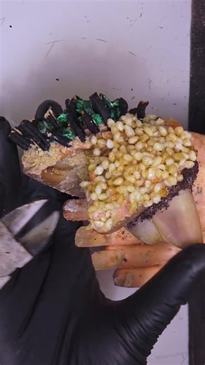 toenail removed successfully #toenails #toenailremoval #toenailfungus #pedicure #ingrowntoenail #onychomycosis #nailcare Disclaimer: These videos are sourced from other platforms, Video Credit to Vietnamese group. They feature artificial toenails for educational and monetization purposes.