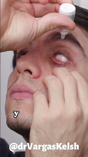 How to apply eye drops? 💧