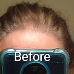 Acomler Root Touch Up Powder, Root Touch Up Hair Color, Talc-Free Hairline Powder for Thinning Hair, Gray Hair Coverage for Women Men, Includes Makeup Brush (Gray, 0.42oz)