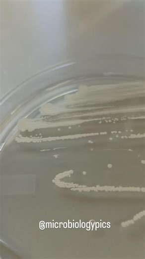 microbiologypics | The catalase test in microbiology detects the catalase enzyme, which breaks down toxic hydrogen peroxide into water and oxygen indicated... | Instagram