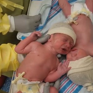 Too precious! Watch as these twins comfort and bond with each other after birth. Every child deserves to be loved and welcomed! | Live Action
