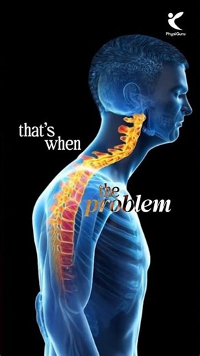 Fix Neck Pain with Right Pillow ✅ #neckpain #neckpainrelief #cervicalspondylosis #cervicalpillow