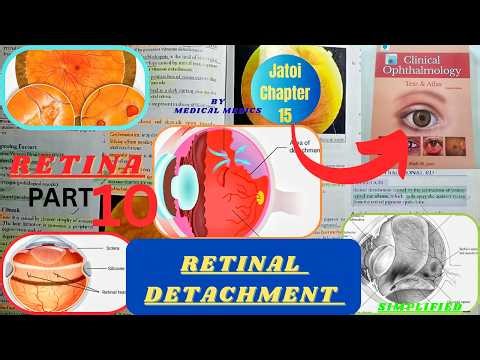 Retinal Detachment | Jatoi Clinical Ophthalmology Chapter 15 Part 10