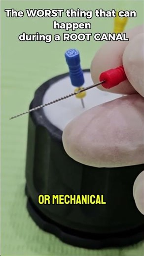 Root Canal Gone Wrong: Broken File #dentist #dentalcare