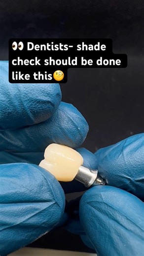 #dentist #dentallaboratory #dentalcaddesign #digitaldentistry #implantdentistry #zirconiacrown