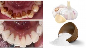 850K views · 10K reactions | Teeth whitening at home in 3 minutes || How to naturally whiten your yellow teeth || 100% effective | Tomi Adenuga | Facebook