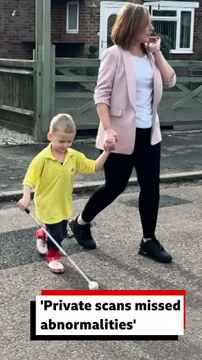 A mother from Camberley is warning pregnant women not to rely solely on private maternity clinic scans after her son was born with severe brain problems. More here: https://bbc.in/4oqcVKM | BBC Surrey
