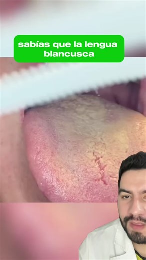 Elimina el sarro de tu lengua con Nutra Gel