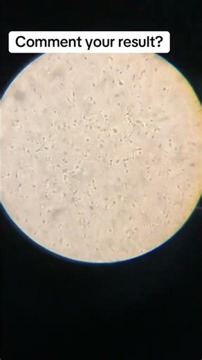 Semen Analysis Test | Sperm Count & Motility Step-by-Step#SemenAnalysis#SpermCount#MotilityTes