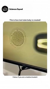 2.4K views | Test tube babies are conceived through in vitro...