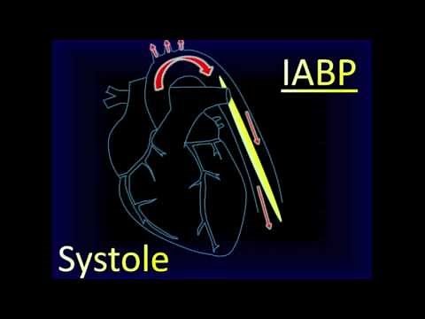 Intra-aortic Balloon Pump Aortic Pressure Curve