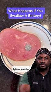 30 reactions · 9 comments | What to Do If a Child Swallows a Button Battery  A swallowed button battery can start causing internal bvrns within a few hours—this is a medical emergency! ✅ Go to the ER immediately—don’t wait! ❌ Do NOT induce vomiting or give food/drink.  If the child is over 1 year old, honey may help on the way to the hospital. Would you have known what to do in this situation? Vote below! ⬇️ | The Whiz Doc | Facebook