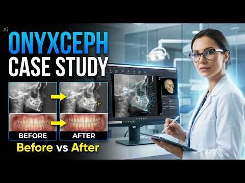 OnyxCeph Case Study | Full Step-by-Step Guide (Before & After)