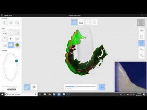 scanning a denture medit i500