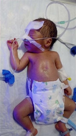 Neonatal Care Birth complication with NICU incubator