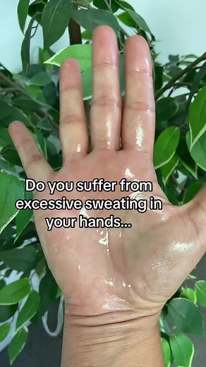 The solution you need for your excessive sweating! 🤗💙💦 Follow @dermadry to learn about our anti-sweat device! #excessivesweating #solution #selfcare #wellness #hyperhidrosis #sweaty #sweatproblems #dermadry #sweatfree | Dermadry