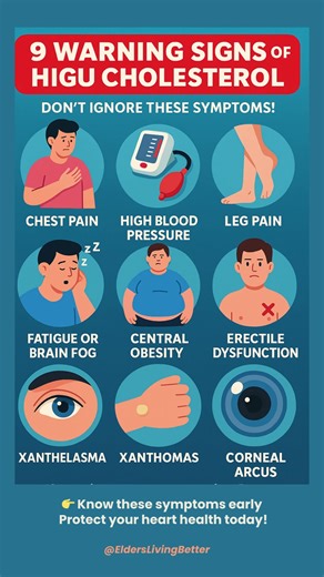9 Warning Signs of High Cholesterol You MUST Notice – Don’t Ignore These Symptoms!