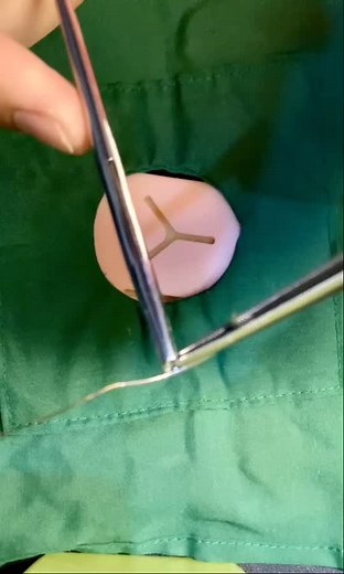 Mastering the Figure of Eight Suture Technique