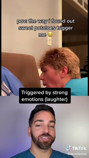 Narcolepsy @narcolepzzz #narcolepsy #narcolepsyawareness #dermatologist #dermdoctor