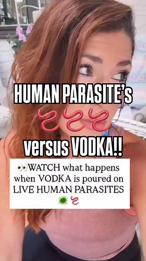 ⚠️VODKA is toxic to humans, so I am not surprised it kills parasites, as it’s a disinfectant but it is not a safe way to deworm or detox! I am not suggesting to try that! . Here are the top 3 most powerful and natural herbs used to kill parasites:👇🏽👇🏽 1. Clove: cloves contain the active ingredient eugenol which can inhibit the growth of parasites and kill them. It also prevents the hatching of eggs 2. Black Walnut Hull: a natural herbicide which contains the active ingredient juglone renowne