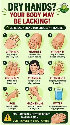 Dry Hands? Your Body May Be Lacking These Nutrients!