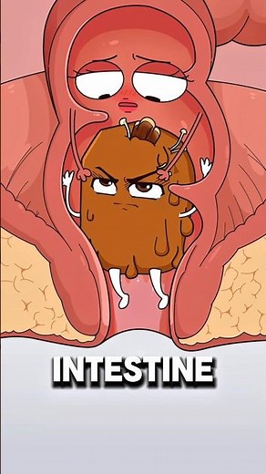 Why Constipation Can Lead to Hemorrhoids ⚠️..!!#e2dhealth #animation #2dshow #health #fypシ