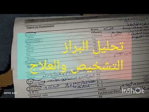 تعلم قراءة تحليل البراز والعلاج المناسب| stool Analysis