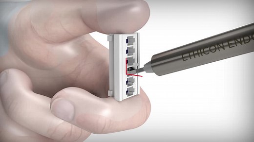 LAPRA-TY™ Suture Clip Applier | Ethicon