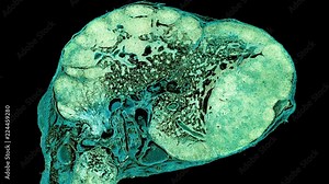 lymphonodus - cross section cut under the microscope – microscopic view of animal cells for education
