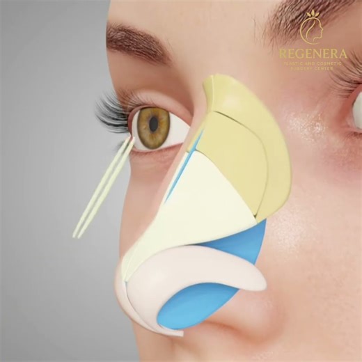RHINOPLASTY OR NOSE SURGERY KAISE HOTI HAI | NOSE COSMETIC SURGERY