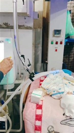 Administration of surfactant to preterm,