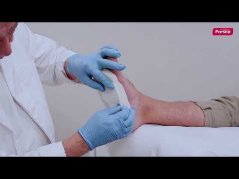 Off-loading from diabetic feet | FRESCO felts
