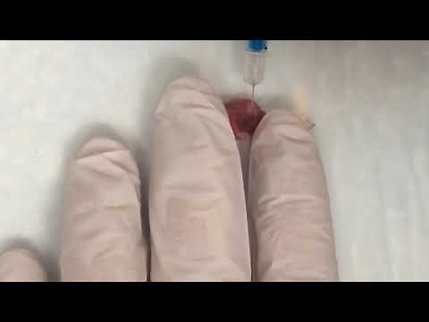 Mouse Facial Vein Injection