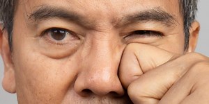 Doctor explains those annoying eye twitches we all get (and when to seek help for it)