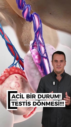Testis Dönmesi: Nedenleri ve Belirtileri