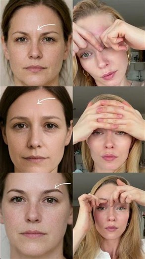 Fix Frown Lines, Forehead Wrinkles & Hooded Eyes | Upper Face Lift Routine