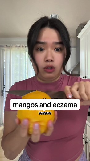 Mango and Eczema: Exploring the Connection