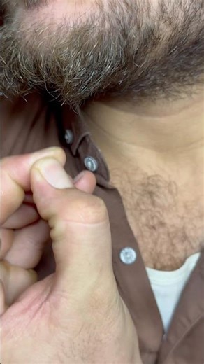 How hair falling out